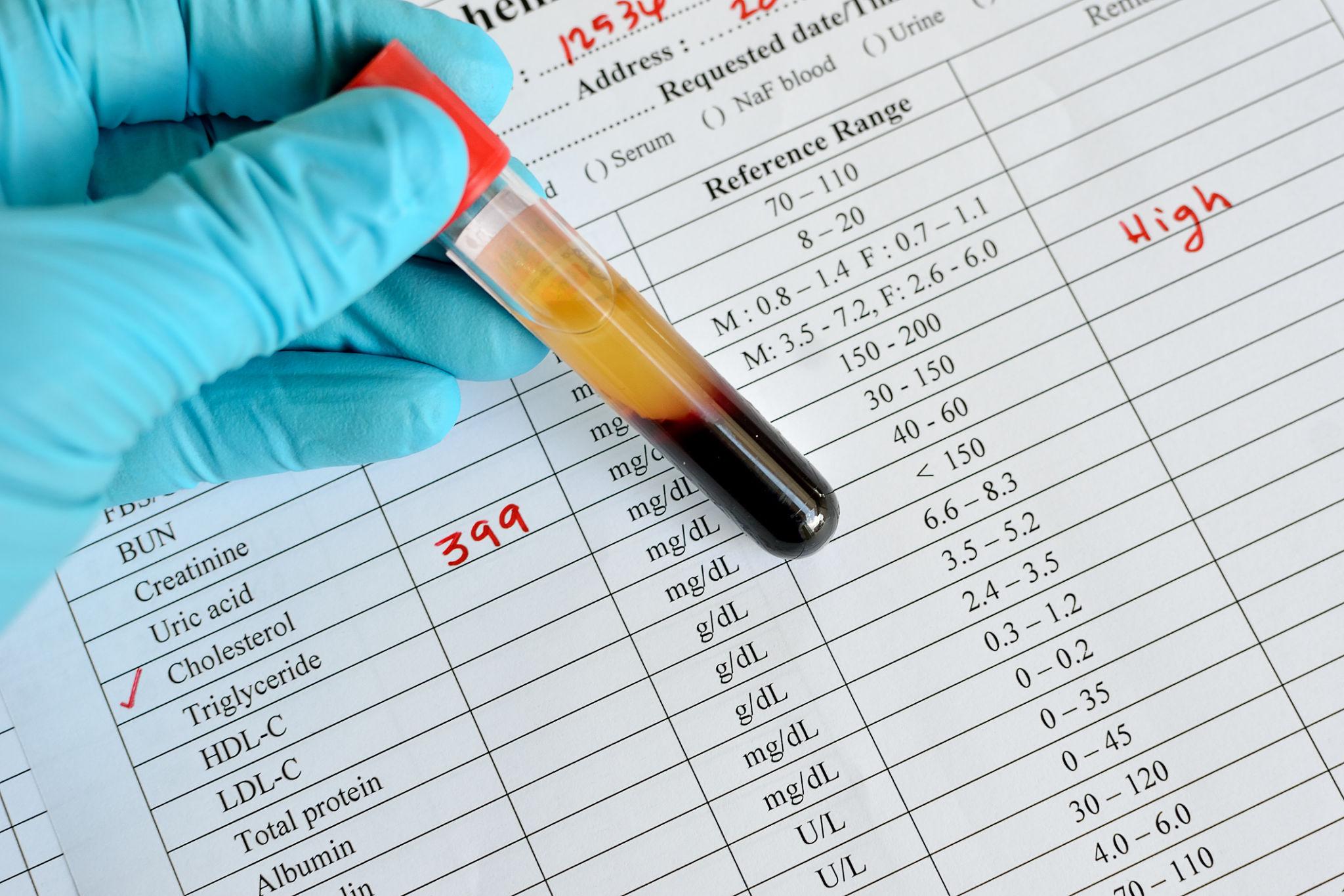 My Cholesterol Was High for Years. Why Did ApoB Finally Get My Attention?